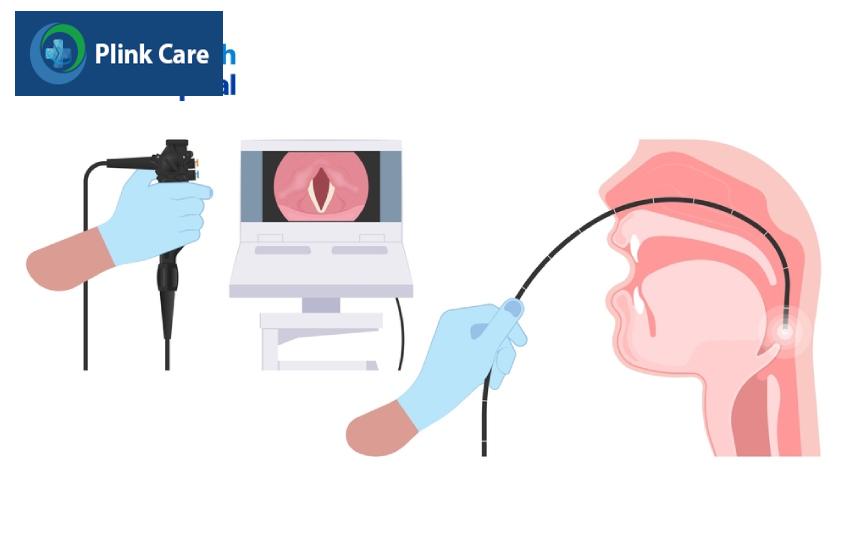 chẩn đoán viêm thanh quản mạn tính