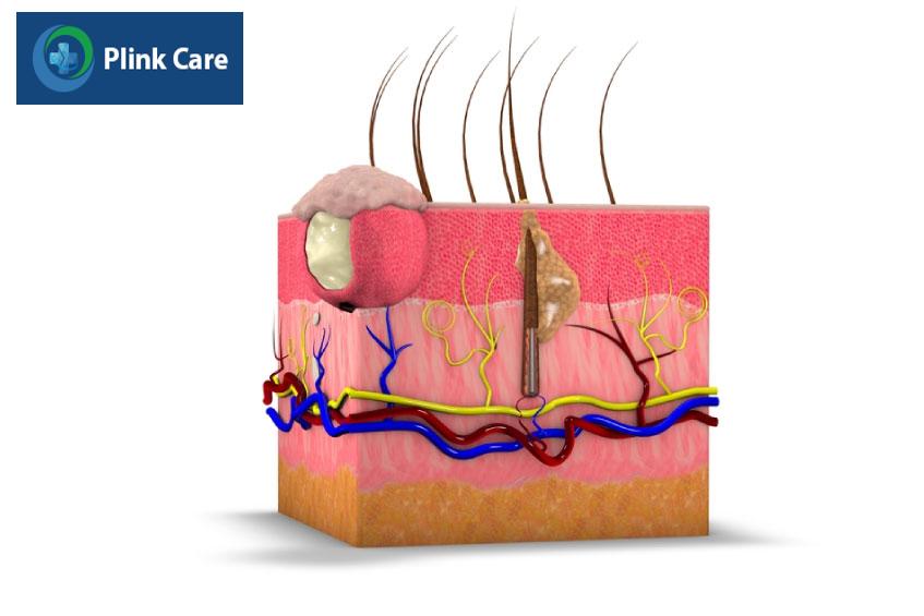 dễ gây biến chứng nếu không được điều trị