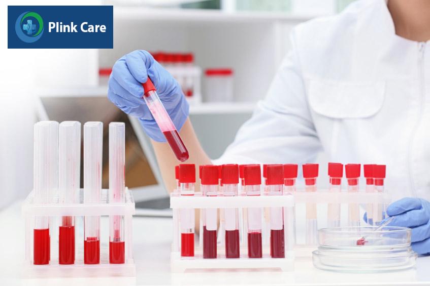 kết quả xét nghiệm creatinine và bun