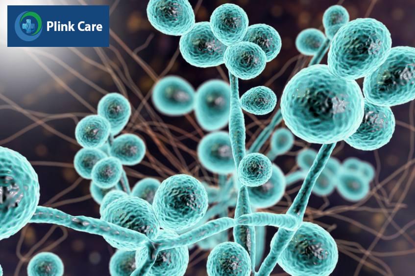 nấm candida albicans là nguyên nhân phổ biến gây nấm da