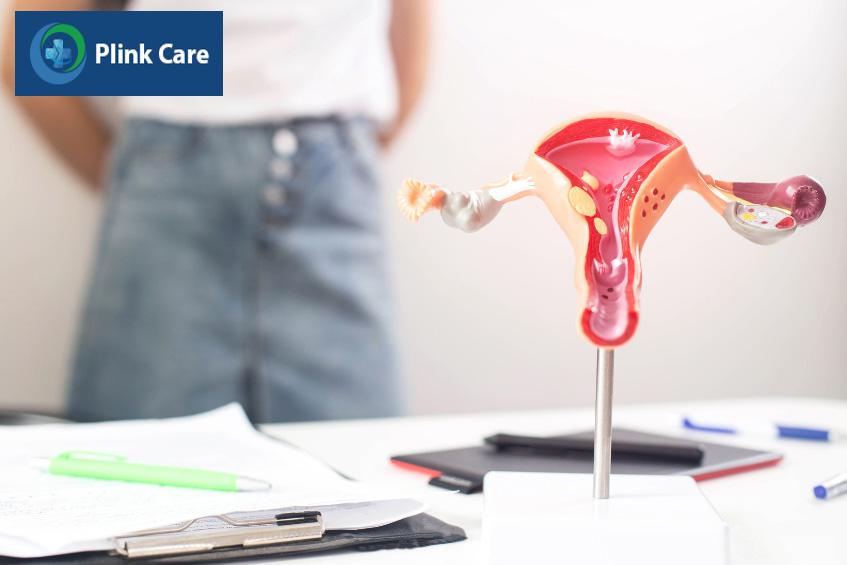 PCOS làm tăng nguy cơ mắc ung thư nội mạc tử cung