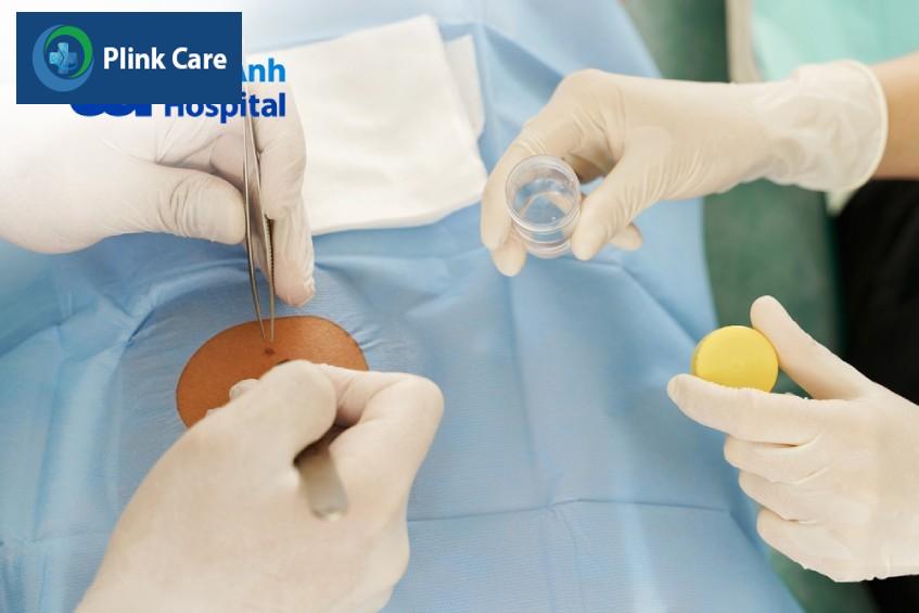 sinh thiết da chẩn đoán bệnh