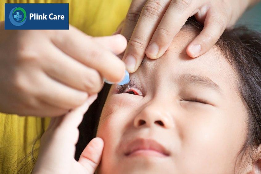 Trẻ bị viêm kết mạc cần được chăm sóc, điều trị đúng cách