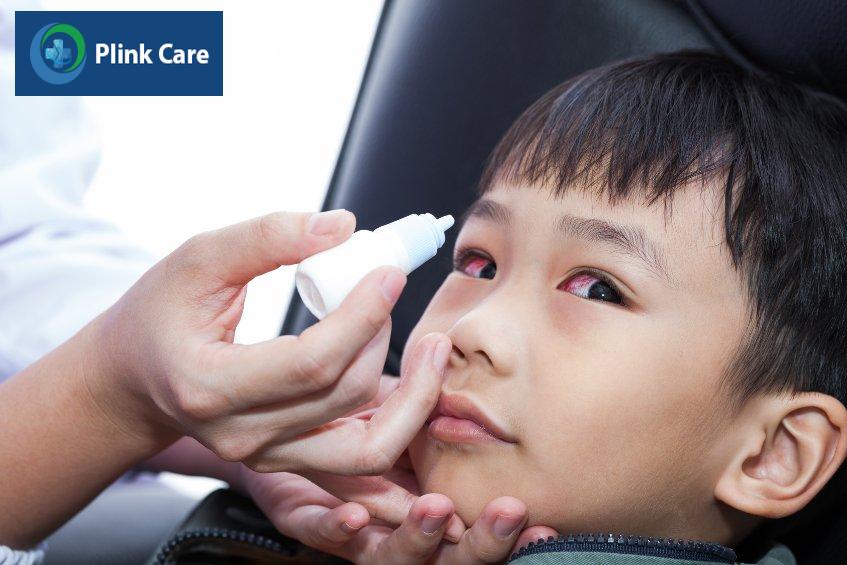 Trẻ bị viêm kết mạc do vi khuẩn có thể được điều trị