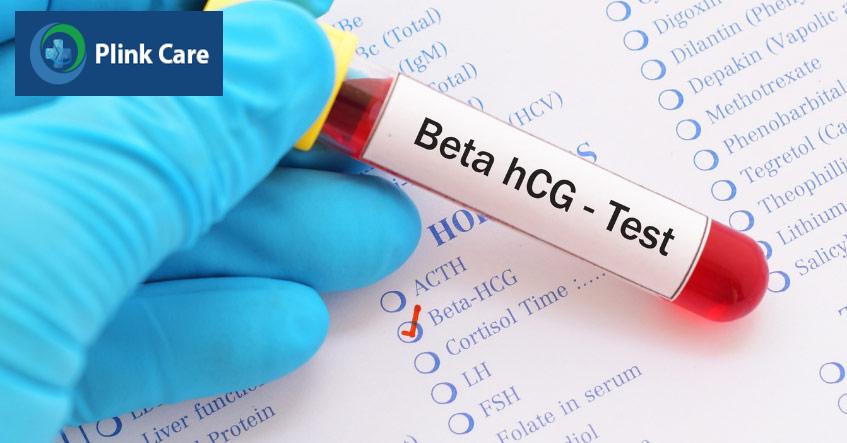Xét nghiệm định lượng beta hCG là thước đo chính xác nhất để biết mang thai hay không sau chuyển phôi