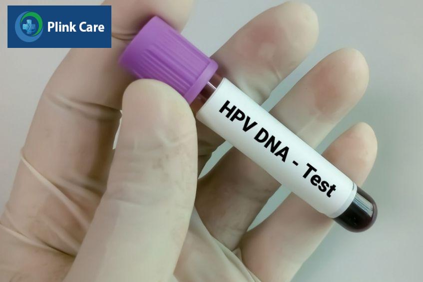 xét nghiệm hpv dna test cho phụ nữ