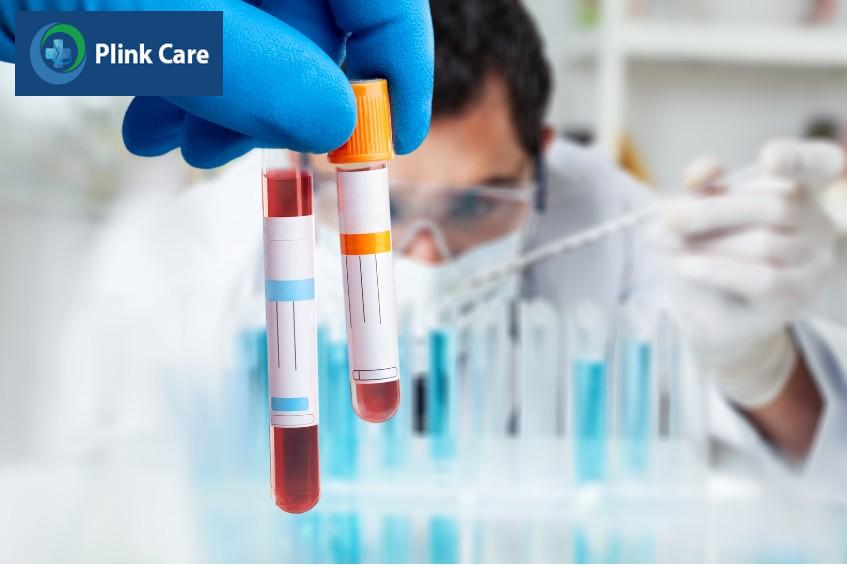 xét nghiệm máu chẩn đoán sốt xuất huyết