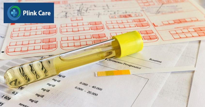 xét nghiệm nước tiểu 24h để làm gì