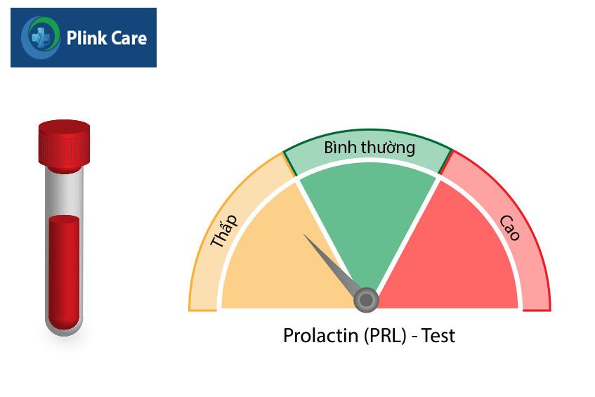 xét nghiệm prolactin được sử dụng để kiểm tra sức khỏe
