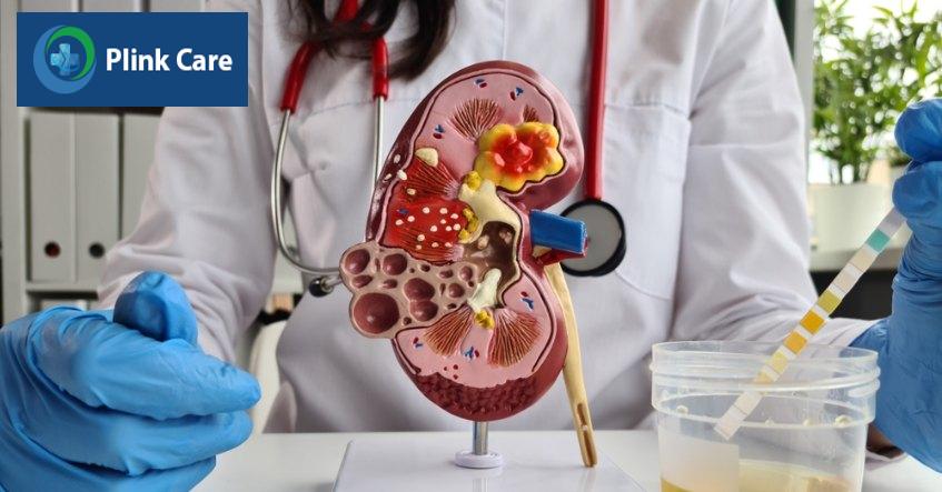 ý nghĩa xét nghiệm nước tiểu 24h