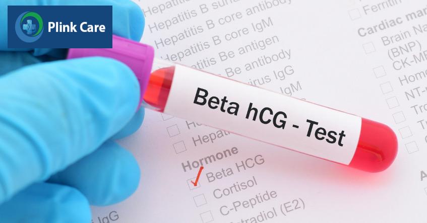 Khoảng 2 tuần sau chuyển phôi, người vợ sẽ làm xét nghiệm máu đo nồng độ beta hCG