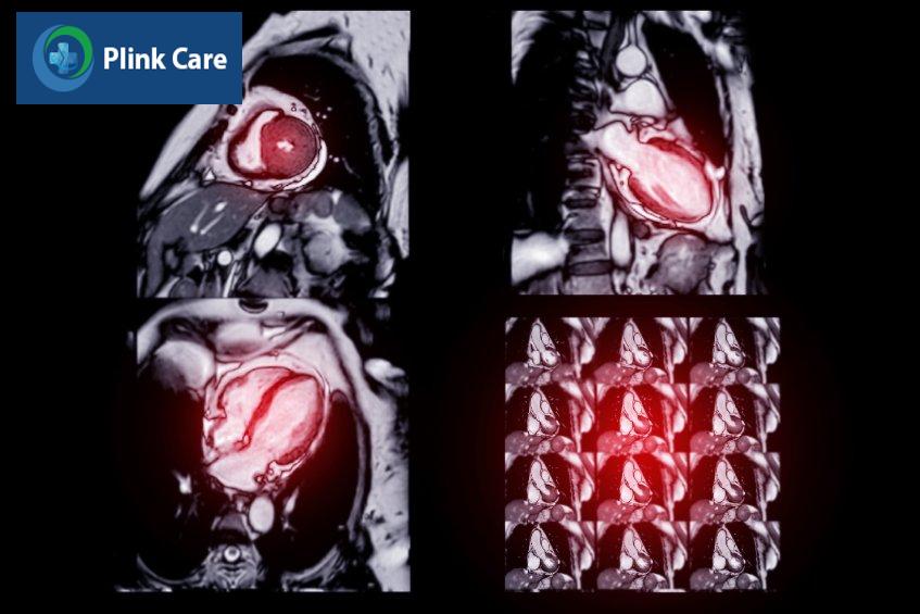 ảnh chụp mri tim