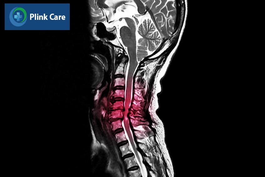 ảnh mri xương khớp
