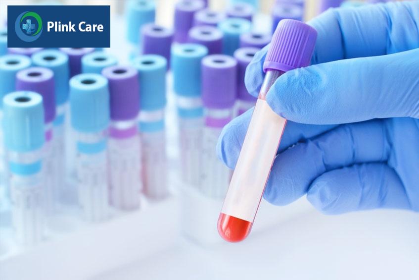 bác sĩ cần khám lâm sàng kết hợp nhiều xét nghiệm khác