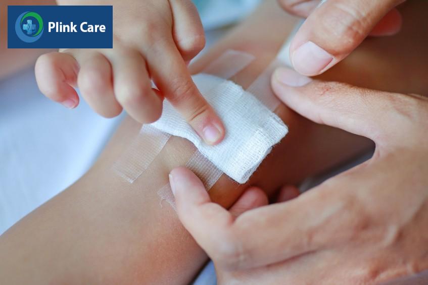 Băng vết bỏng đúng cách để ngăn ngừa nhiễm trùng
