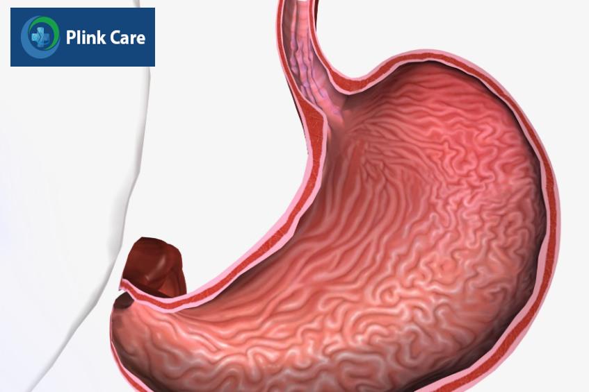 cách điều trị hẹp thực quản
