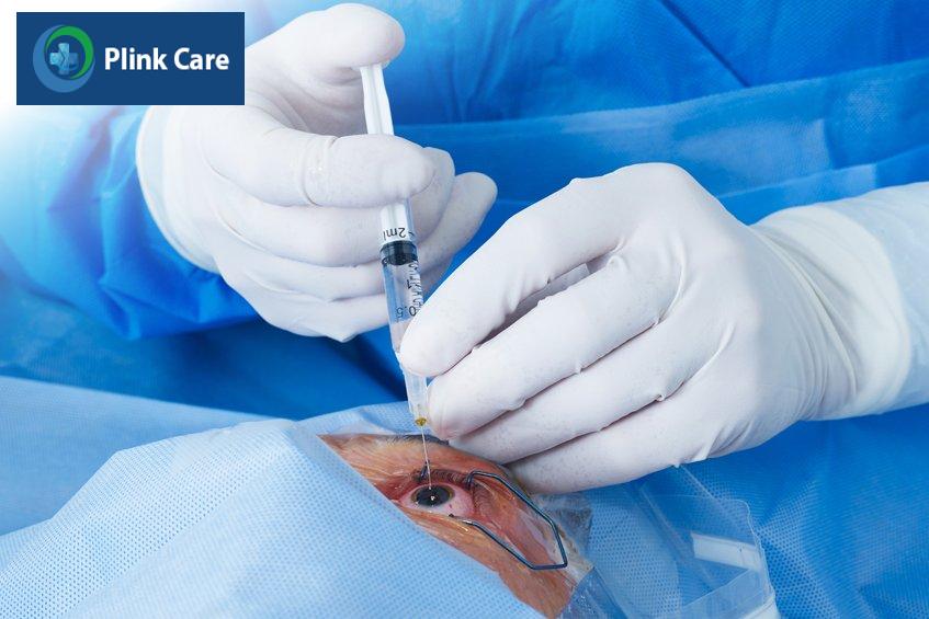 cắt dịch kính thực hiện khi có chỉ định