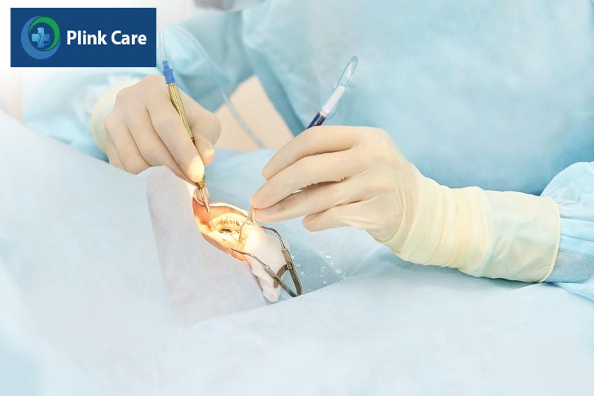 cắt dịch kính trong một số trường hợp