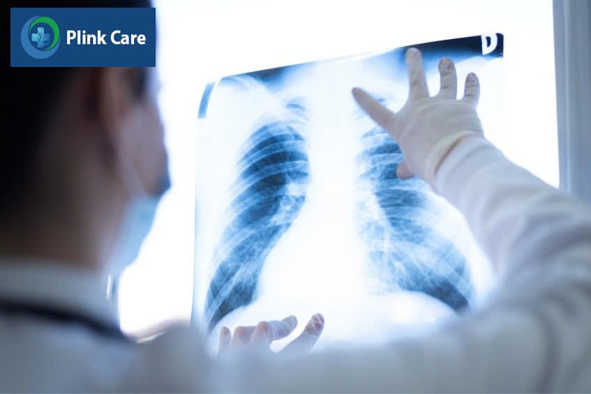 Chẩn đoán viêm phế quản bằng xét nghiệm chẩn đoán hình ảnh