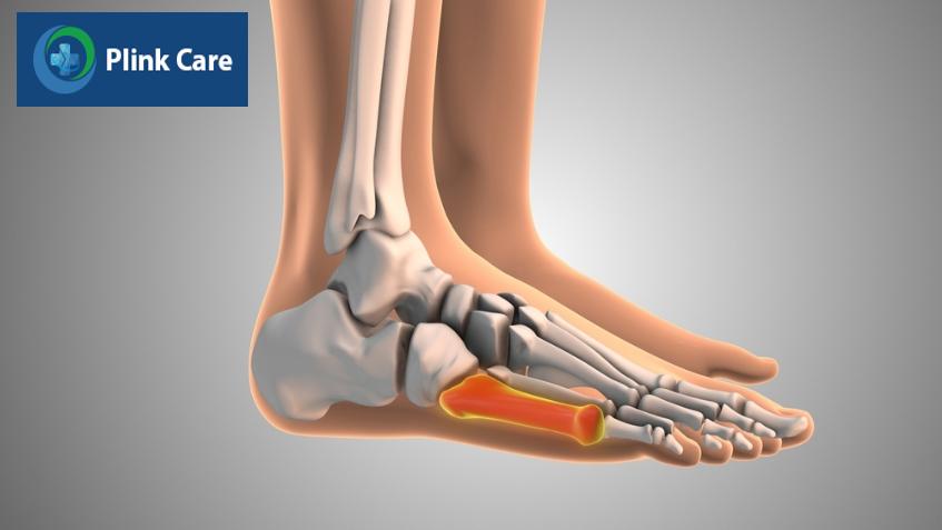 chụp ct đánh giá ung thư di căn xương.
