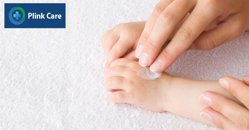 điều trị bằng thuốc bôi ngoài da có kê đơn