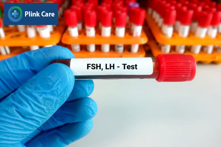 định lượng fsh và lh