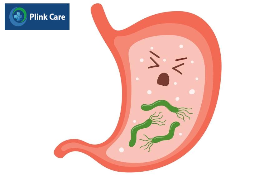 do sự tấn công của vi khuẩn Helicobacter Pylori