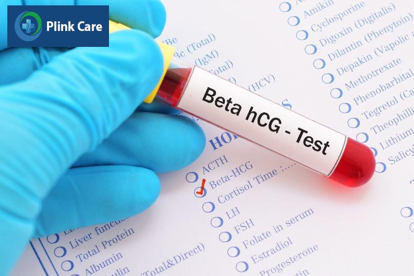 Kết quả xét nghiệm beta-hCG có thể biết được kết quả phôi thoát màng và làm tổ thành công