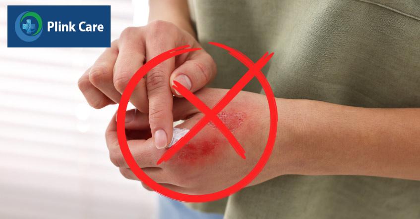 không tự ý bôi kem dầu hoặc bất cứ thứ gì