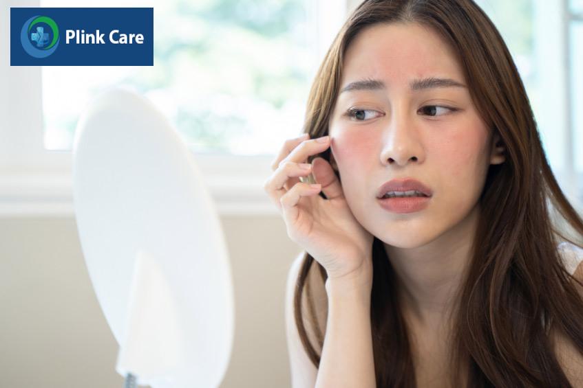 mẹ bầu thường bị nổi mụn trứng cá ở mặt