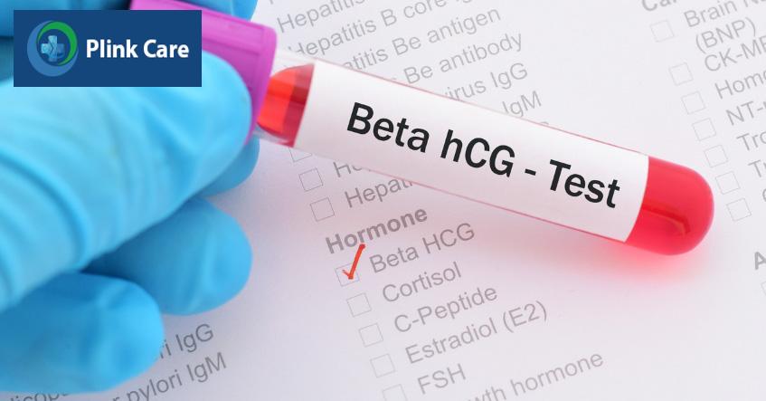 Nồng độ beta hCG âm đồng nghĩa chuyển phôi ngày 5 không thành công