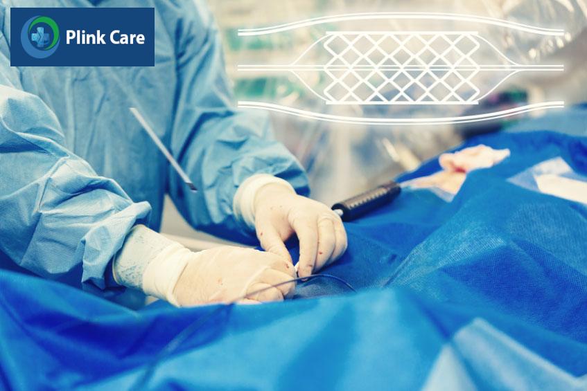 Rủi ro nghiêm trọng khi can thiệp mạch vành là khá thấp
