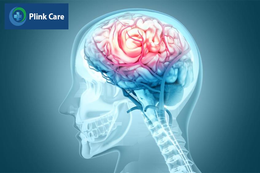thiếu máu não có thể gây đau đầu sau khi ngủ trưa