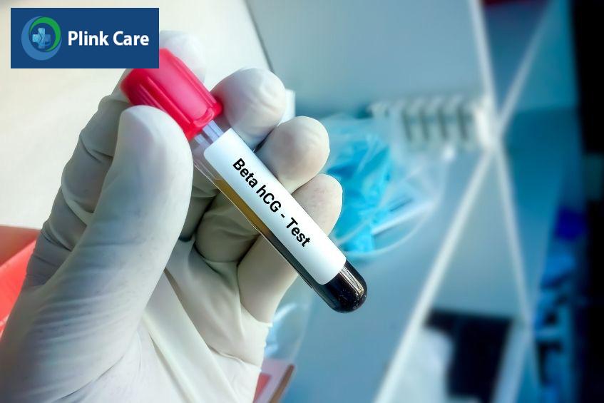 Thời điểm xét nghiệm quá sớm có thể ảnh hưởng đến chỉ số beta không chính xác