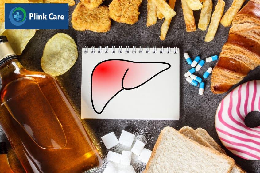 Các loại thực phẩm nên tránh trong thực đơn cho người bệnh xơ gan