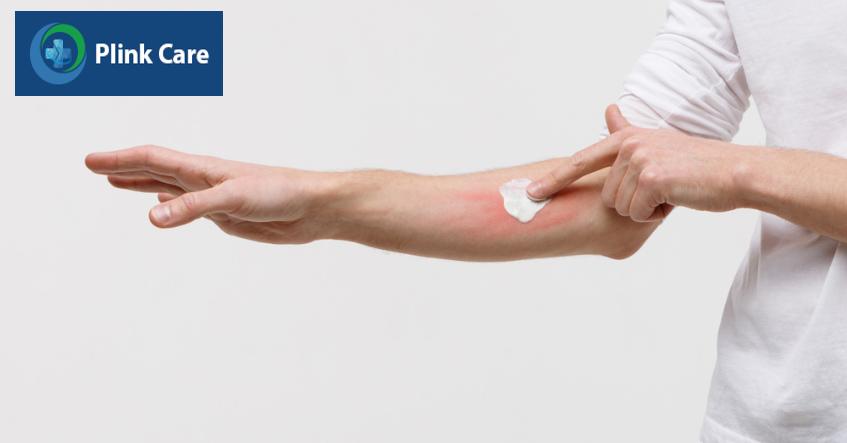 thuốc bôi ngoài da điều trị ghẻ