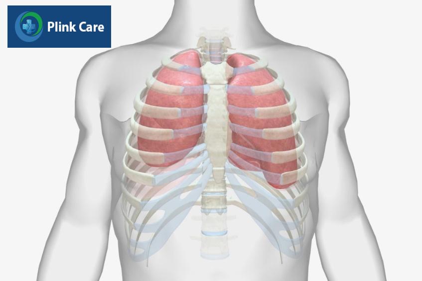 Tràn mủ màng phổi không điều trị kịp thời sẽ dẫn đến xẹp phổi