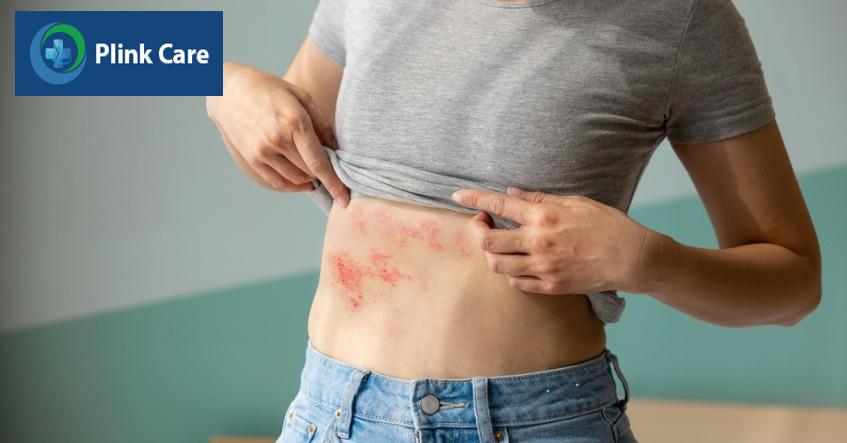 triệu chứng dị ứng thuốc bị ngứa