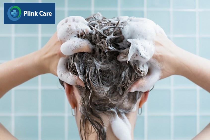 tùy trường hợp sốt xuất huyết có thể gội đầu