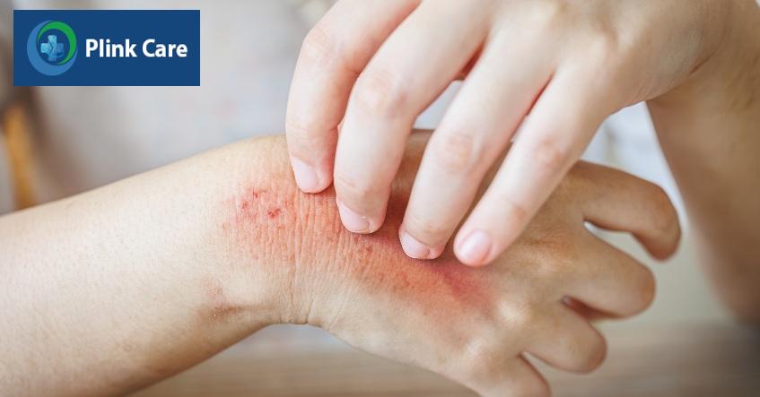 vì sao cần khám da liễu