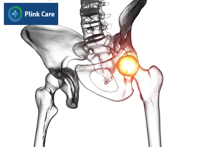 Viêm cơ hoại tử qua trung gian có thể gây tàn tật nếu điều trị muộn