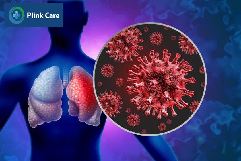 Giảm nguy cơ mắc bệnh viêm phổi do virus