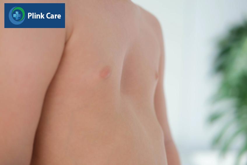 vitamin d rất quan trọng cho việc hấp thu canxi