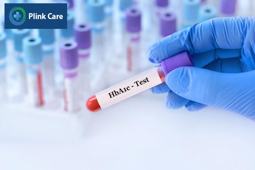Xét nghiệm HbA1c là một trong những xét nghiệm bắt buộc
