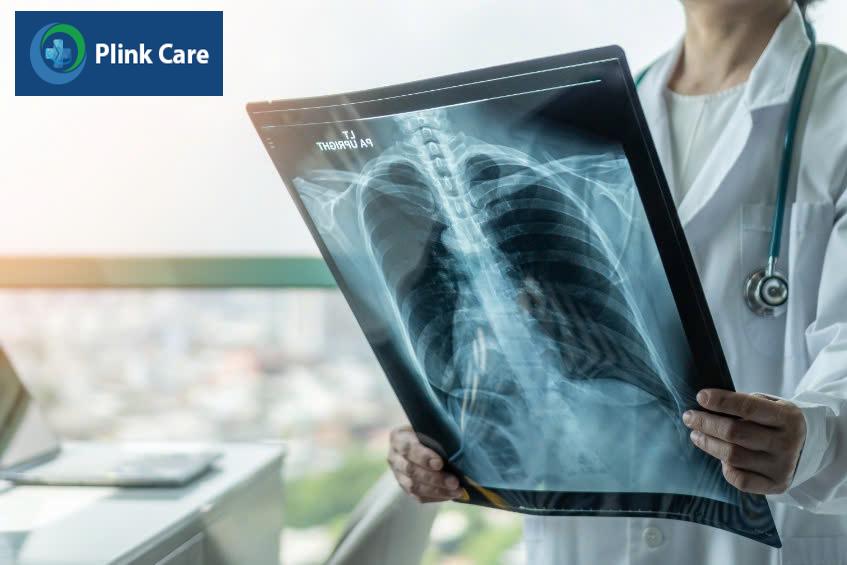 Xét nghiệm hình ảnh chẩn đoán viêm phế quản cấp