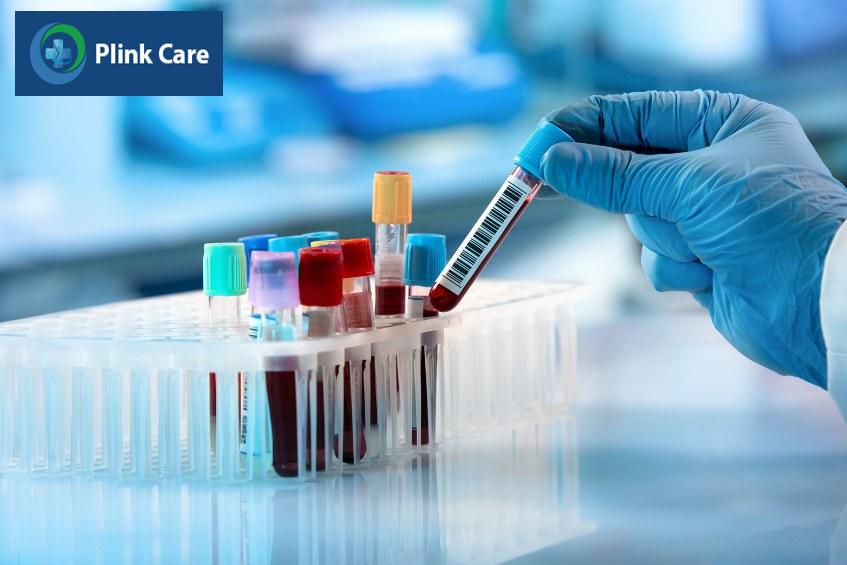 xét nghiệm huyết thanh chẩn đoán nhiễm cmv