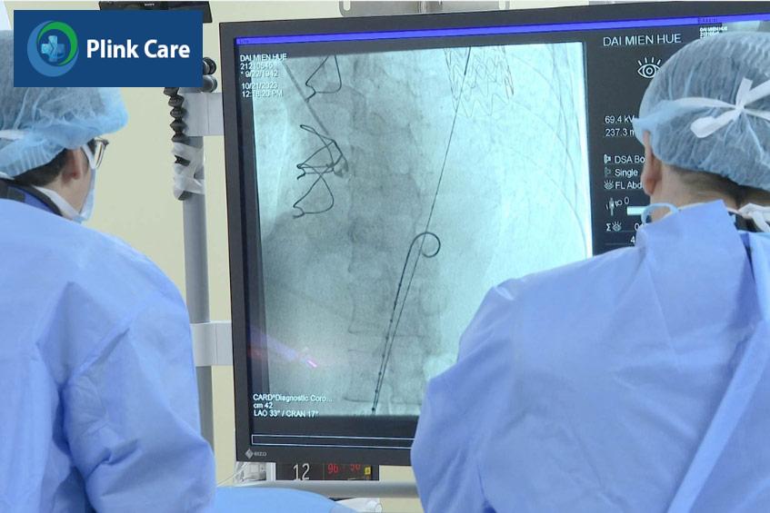Bác sĩ thực hiện thủ thuật đặt stent mạch vành