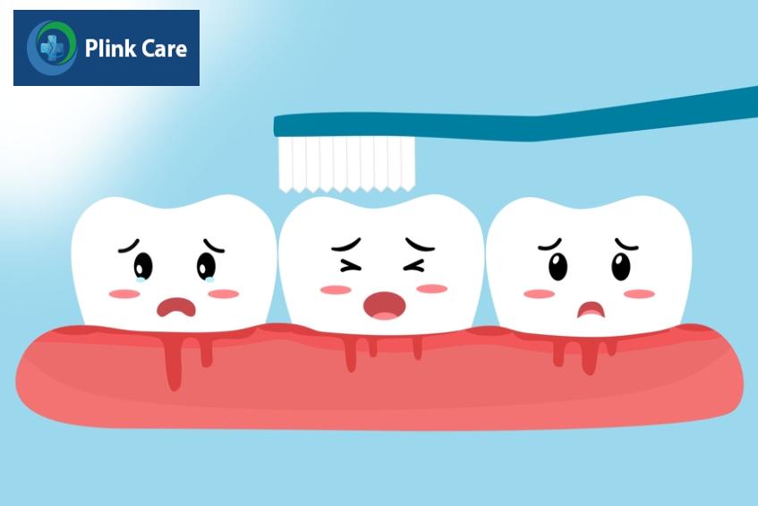 Các yếu tố làm tăng nguy cơ bị sưng lợi