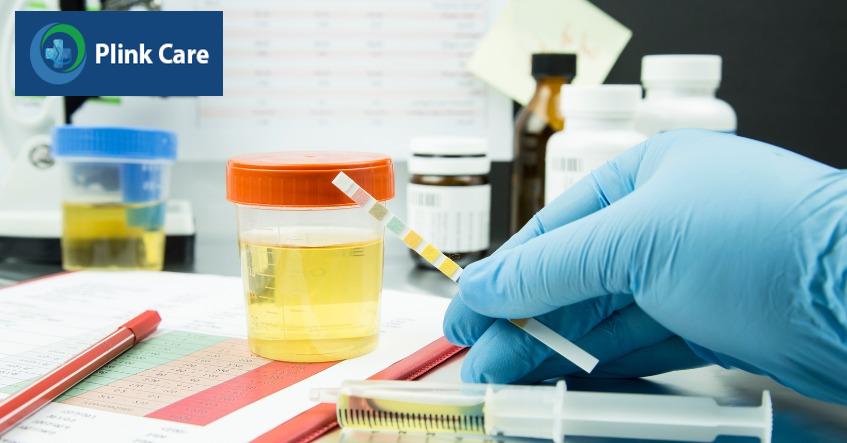 các triệu chứng đặc hiệu viêm cầu thận thường chỉ được nhận thấy qua kết quả xét nghiệm nước tiểu
