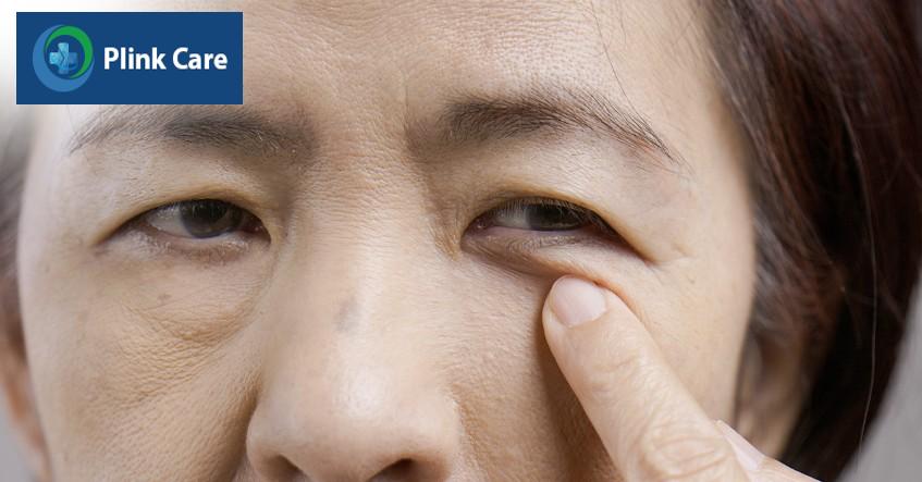 cao tuổi dễ bị thoái hóa võng mạc